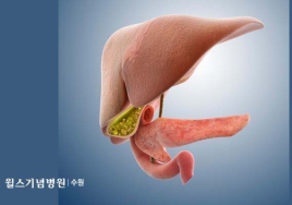 [일문일답 생활 속 건강] 담석증 치료 어떻게?