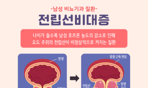 전립선 질환의 예방과 치료 ② 전립선 비대증 원인과 증상