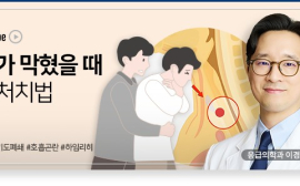 기도가 막혔을 땐 응급처치 어떻게?